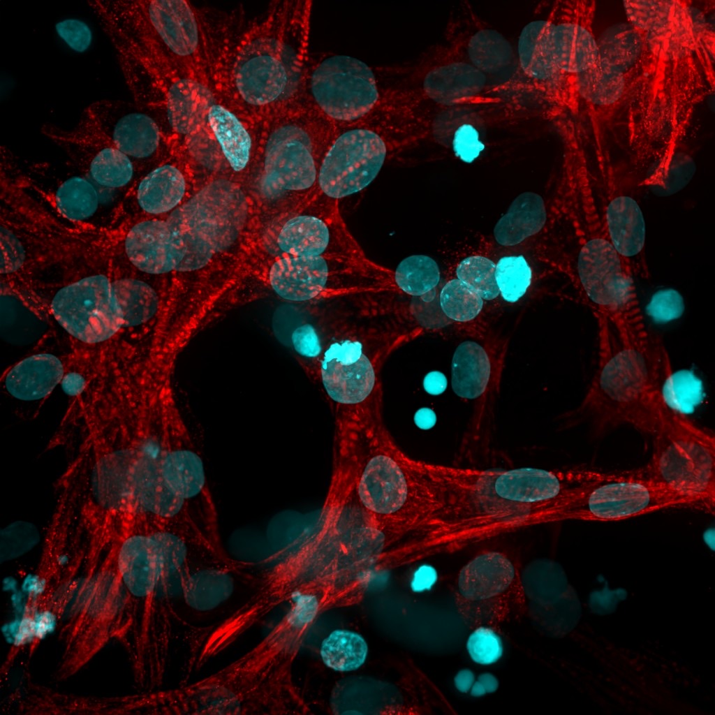 Healthy Cardiac Tissue